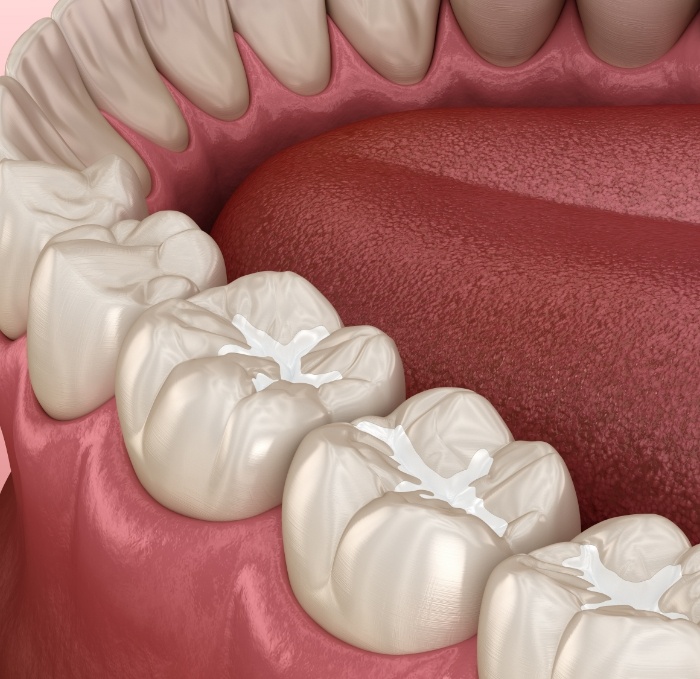 Animated row of teeth with dental sealants