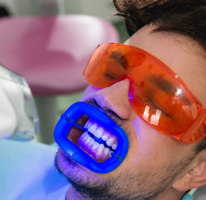 Man getting professional teeth whitening from cosmetic dentist