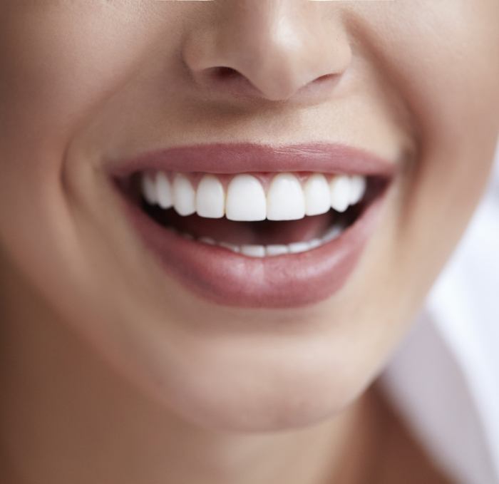 Close up of smile with straight white teeth and even gumline