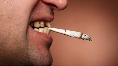 Person holding cigarette between their teeth