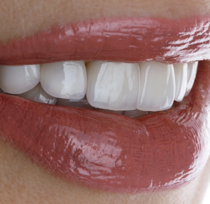 CLose up of smile with straight white teeth after full mouth reconstruction in Brandon
