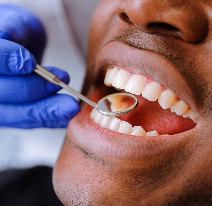 Man with dental mirror inside of his mouth