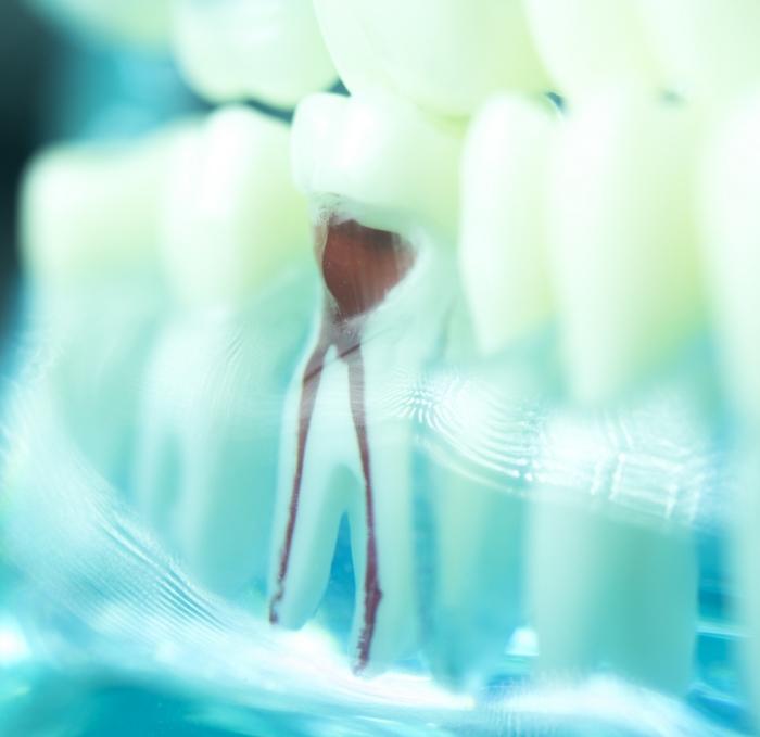 Model of a tooth showing the root canals inside of it