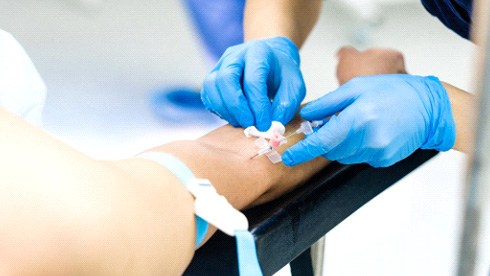 IV sedation being administered at a Brandon dental office