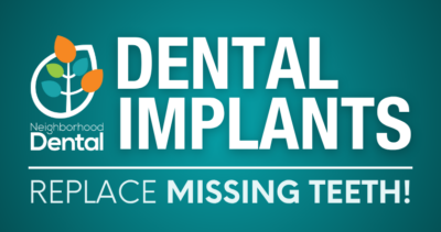 Am I a candidate for dental implants. Take a quiz to find out in less than 30 seconds.